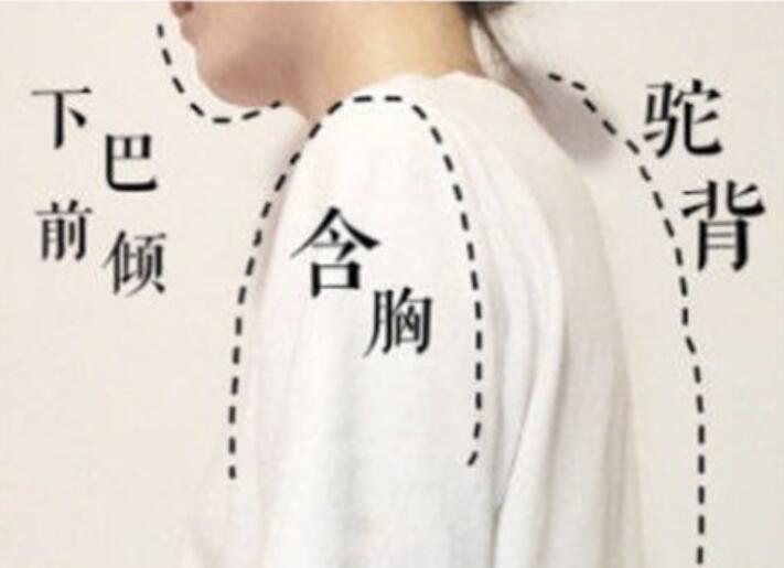 南寧美容學校：堅持一個月，駝背變直背