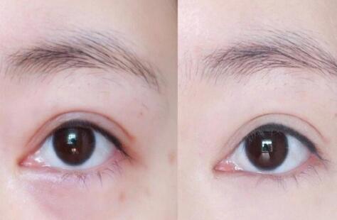 化妝教程：淚溝眼袋黑眼圈遮瑕大法