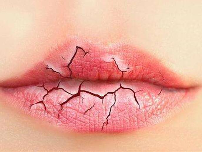6個美容技巧，解決秋季嘴唇干燥