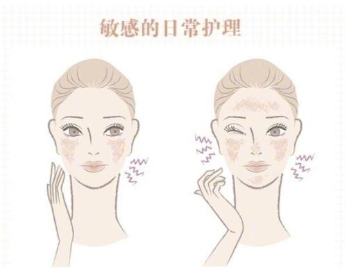敏感肌保養(yǎng)大全！
