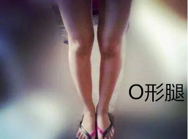 糾正你的腿型！