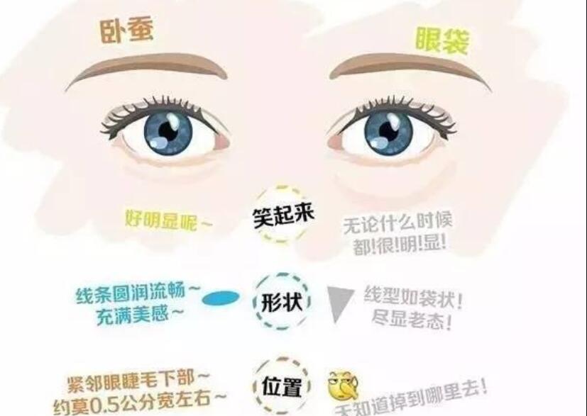 眼袋還是臥蠶，快來(lái)學(xué)辨別的方法