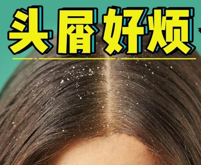 南寧正規(guī)美發(fā)培訓(xùn)學(xué)校分享：冬天如何減少頭屑過多？
