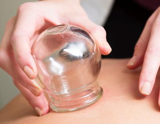 4種不同的拔罐方法，廣西美容學(xué)校整理好了