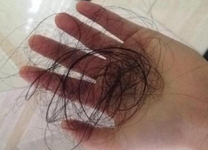 脫發(fā)女孩必備寶典！南寧美發(fā)學校教你