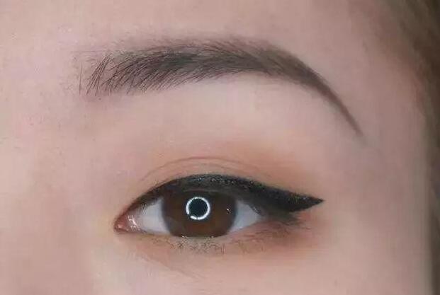 眼尾三角區(qū)怎么處理？