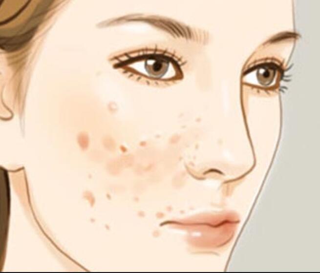 廣西美容師培訓正規(guī)學校：專治色斑的寶藏水果