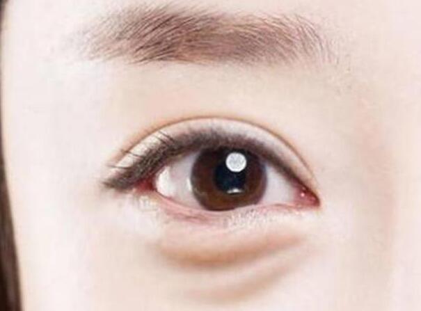 眼袋？淚溝？臥蠶？南寧美容學校教你辨別