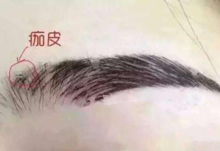 紋眉結(jié)痂時(shí)要注意什么？麗紋竹繡學(xué)校教你