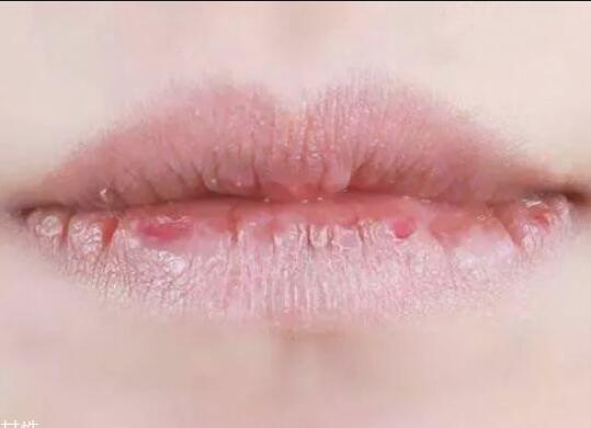 紋唇后嘴巴干燥怎么辦？南寧教紋繡的學校幫你解決