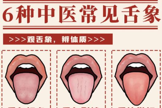6種常見(jiàn)中醫(yī)舌診判定，快和廣西中醫(yī)美容一起學(xué)