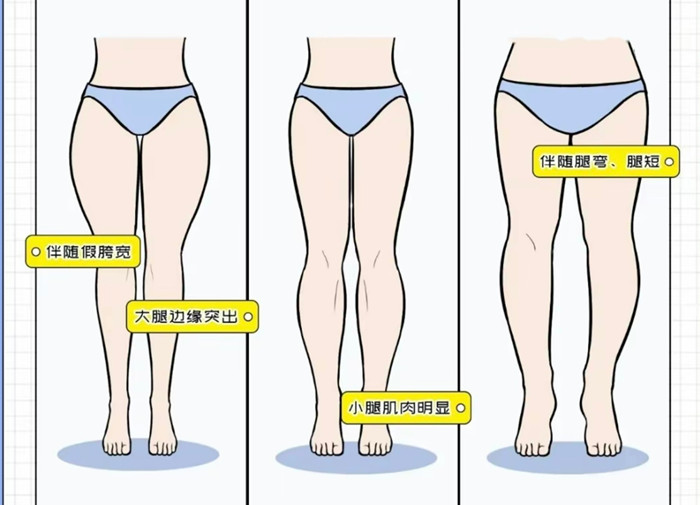 腿粗女生穿搭攻略，廣西彩妝造型搭配