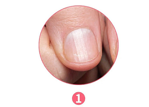 女生氣血不足六大表現(xiàn)，南寧美容養(yǎng)生資訊報道