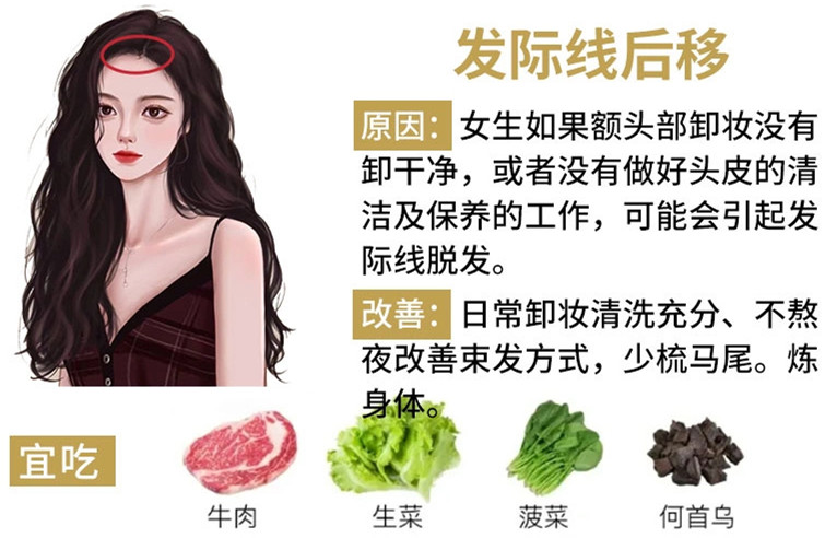 如何改善掉頭發(fā)？南寧頭療養(yǎng)發(fā)護(hù)發(fā)教學(xué)