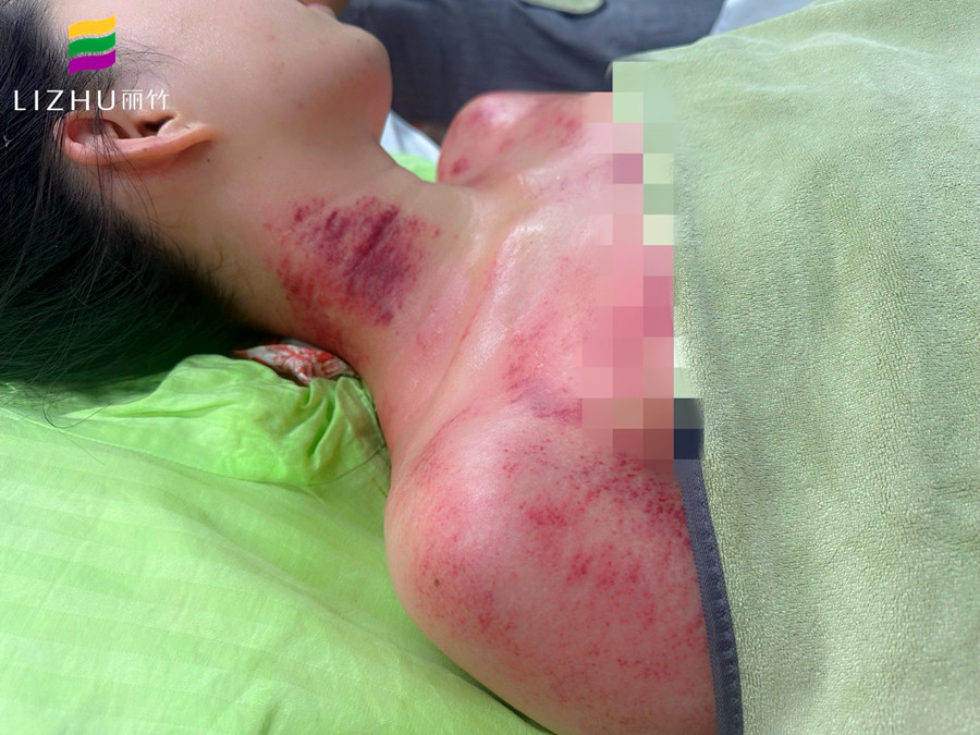 廣西學(xué)刮痧培訓(xùn)班 | 廣西學(xué)刮痧學(xué)費(fèi)多少？