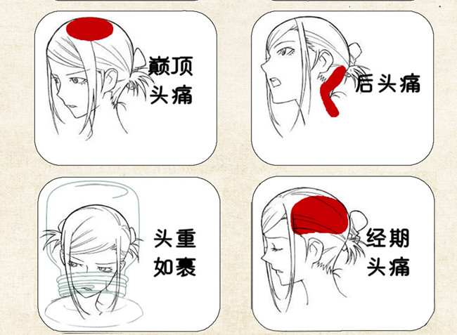 不同頭痛類(lèi)型經(jīng)絡(luò)護(hù)理方法，廣西中醫(yī)美容培訓(xùn)