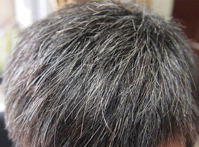 南寧美發(fā)基礎(chǔ)教學(xué)：為什么會(huì)長(zhǎng)白頭發(fā)？