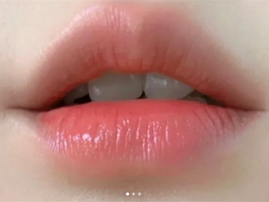 廣西學(xué)紋唇：紋唇遇到組織液時如何應(yīng)付？