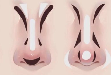 廣西習(xí)化妝排名：不同鼻型如何修容？